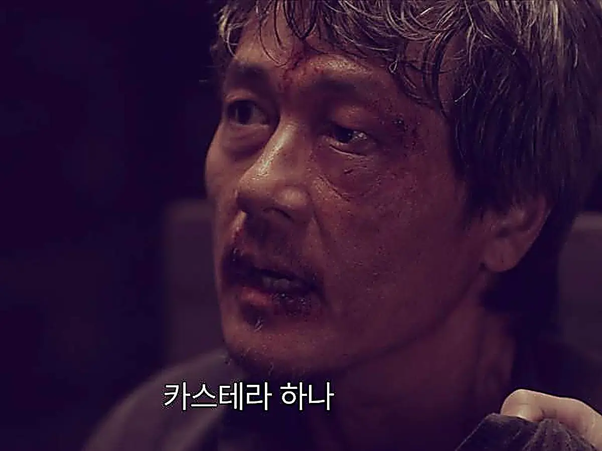 A man with facial bruises and cuts looking upward in a dimly lit room